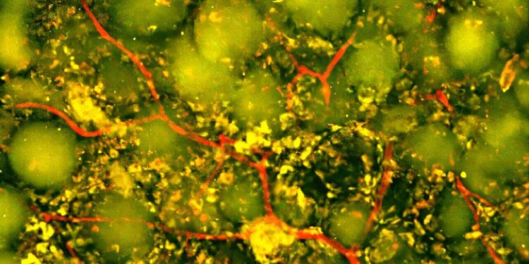 Study finds new stroke treatment with injectable biomaterial